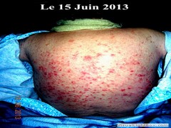 DosLe15Juin2013DevientUrgent2